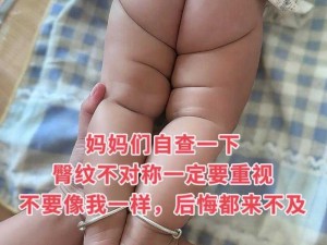 宝宝腿抬起来就不疼了，用 XX 帮你轻松解决